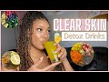 3 DETOX JUICE RECIPES FOR CLEAR  SKIN| Hormone regulating & anti inflammatory drinks that fight acne