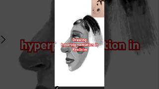 Drawing #hyperpigmentation in Realisim #meme #Shorts #YouTubeShorts #Trending #Viral #Explore #funny