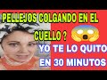 COMO ELIMINAR FLACIDEZ PROFUNDA EN EL CUELLO #cuello