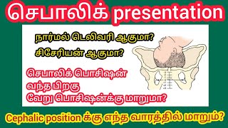 cephalic position அறிகுறிகள் என்னென்ன?