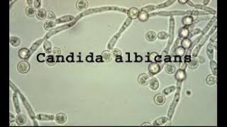 Episode 132 - Candida Albicans | A Cause of Chronic Fatigue, Bad Breath, Weight Gain \u0026 More