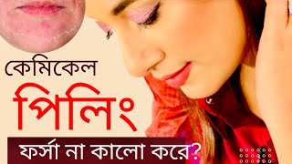 কেমিক্যাল পিলিং করে ত্বক ফর্সা?