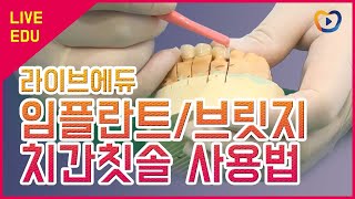 [라이브에듀]  임플란트나 브릿지의 치간칫솔법을 알아보자.