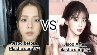 Jisoo before Plastic surgery vs after plastic surgery 😂