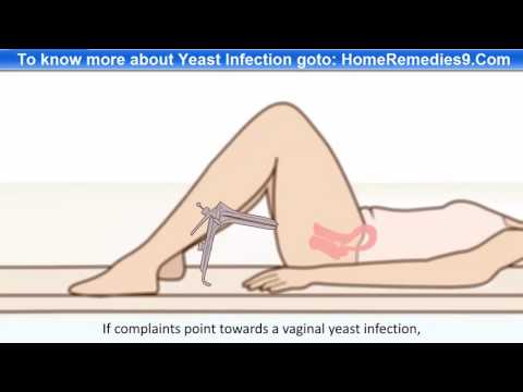 Yeast Infection - Causes, Symptoms And Treatment Of Vaginal Yeast Infection Yeast Infection - Causes, Symptoms And Treatment Of Vaginal Yeast Infection