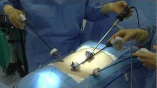 Laparascopic Hysterectomy Simulation Training