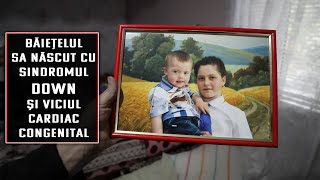 Băiețelul sa născut cu sindromul down  și viciul cardiac congenital !!!