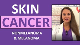 Skin Cancer: Basal, Squamous Cell Carcinoma, Melanoma, Actinic Keratosis Nursing NCLEX