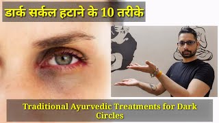 What Causes Dark Circles Under Eyes? | How to get rid of Dark circles | #ayurveda #darkcircles