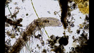 Worm eating under a microscope