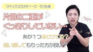 【再手術】術後、片目の二重がくっきりしていない…縫い直してもらった方が良いですか？【二重整形】