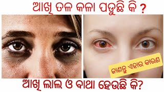 ଆଖିତଳ କଳା ହେବାର କାରଣ ।। Causes of dark of the under eye VP NEWS ODIA