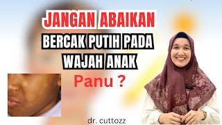 WASPADA BERCAK PUTIH DI WAJAH ANAK | dr cuttozz