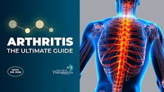 Arthritis Relief: the ULTIMATE Guide (Doctor-Approved Tips for a Better Life)