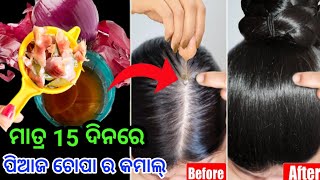 ପିଆଜ ଚୋପା ର କମାଲ ମାତ୍ର ୧୫ ଦିନ ରେ 🤩 || ଗୋଟିଏ ବି ଚୁଟି ଝଡିବନି 😱|| Hair Care Tips  Odia || Richa Tips..