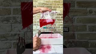 Sepsis When Blood Vessels Explode Into Leaks