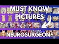 100 Anatomical Pictures You Must Know - Neurosurgeons, Neuroradiologists & Neuro Enthusiast - Part 1