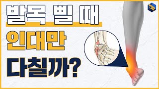 발목이 삘 때 인대만 다칠까?? | +신경이완법