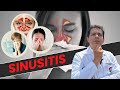 SINUSITIS CÚRELA CON MEDICINA NATURAL HOLISTICA