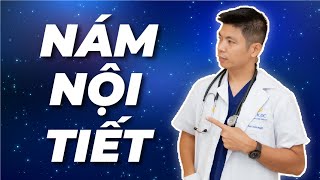 Thăm khám online cùng Dr Ngọc - Case Nám Nội Tiết