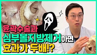 같이하면 좋은 수술, 윤곽수술 전 심부볼지방부터 체크!