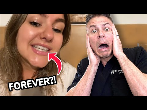Do you really have to wear your retainer forever?