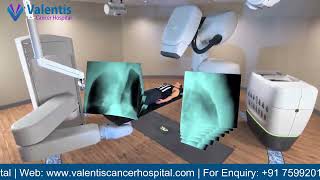 PATIENT WORKFLOW on Cyberknife S7 -robotic radiation therapy machine for treating scarless cancer