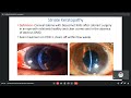 early and late postoperative complication of cataract surgery dr. pranav patil 04 june 2021