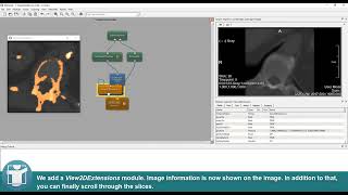 MeVisLab Tutorials - Visualization - Snapshots and Movies
