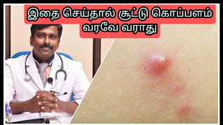 வெய்யில் கால தோல் பராமரிப்பு | Skin care during summer | Tamil | Dr Sudhakar |