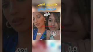 طلاب ستار أكاديمي قبل وبعد البرنامج