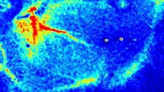 Laser Speckle Contrast Imager System - Pseudo color -  Heart 2