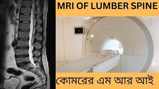 MRI OF L S SPINE. কোমরের এম আর আই