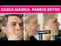 CASCA PODEROSA - 10X MELHOR QUE BOTOX, ESTICA AS RUGAS E CLAREIA MANCHAS EM 12 MINUTOS