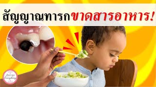 อาการทารก : สัญญาณที่บอกว่าทารกขาดสารอาหาร  | อาการเด็กทารก | เด็กทารก Everything