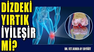 DİZDEKİ YIRTIK İYİLEŞİR Mİ? #aktifizyo #fiziktedavi #dizkireçlenmesi