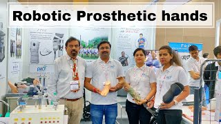 बिलकुल असली जैसे देखने वाले नकली हाथ | Bionic prosthetic hands in india