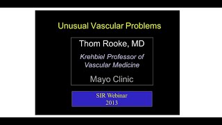 SIR-RFS Webinar (3/6/13): Unusual Vascular Diseases - An Overview