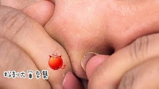 MKUP美咖 【立即趕走粉刺大軍 洗出光滑保濕亮白肌】