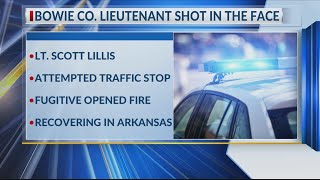 Bowie County Lieutenant to lose one eye after being shot in face