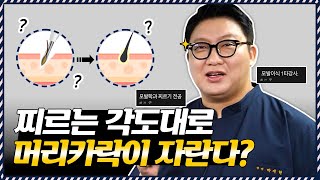 의느님답변📂모발이식한 방향대로🌱이식모가 자란다?  Part.1ㅣ다나성형외과(DANA)ㅣ모발이식ㅣ헤어라인교정ㅣ두피문신ㅣ탈모치료