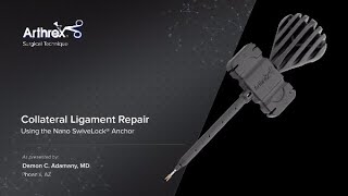 Collateral Ligament Repair Using the Nano SwiveLock® Anchor