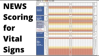 How to Fill in a NEWS Chart | OSCE Revision