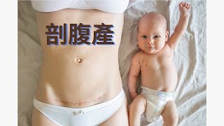 鄰舍頻道 健康抗疫︰新手媽媽 中醫保健法 03 剖腹產調理