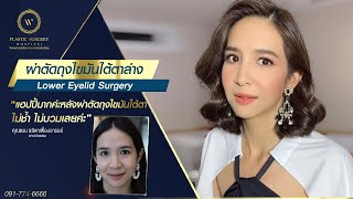 ผ่าตัดถุงไขมันใต้ตา หลังทำไม่ช้ำ ไม่บวมเลยค่ะ ‼️ คุณแนน ชลิตา