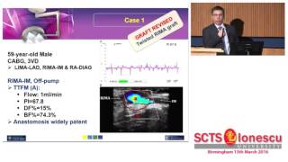 The complimentary relation of high-resolution Epi-Cardial Imaging and Transit Time Flowmetry