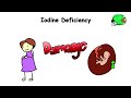 every nutritional deficiency explained in 14 minutes