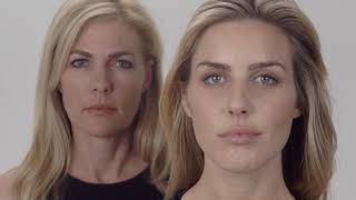 Galderma "Facial Aging" at Sanova Dermatology
