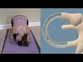 Half Somersault Maneuver для лечения головокружения Bppv
