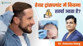 हेयर ट्रांसप्लांट में कितना खर्चा आता है? | Cost of Hair Transplant in Delhi | Hair Transplant Cost